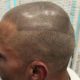 Tricopigmentazione capelli