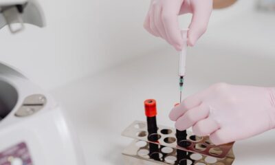 Analisi del Sangue