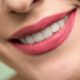 Sorriso Denti